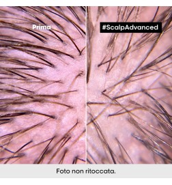 L'OREAL PROFESSIONNEL - SCALP ADVANCED - Dermo Regolatore Shampoo (500ml) Shampoo calmante lenitivo