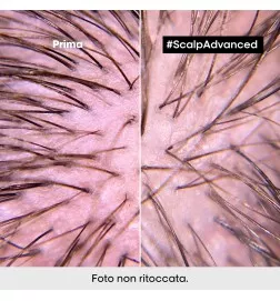 SCALP ADVANCED - Dermo Regolatore Shampoo (1500ml) Shampoo calmante lenitivo