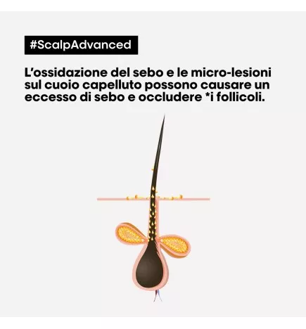 L'OREAL PROFESSIONNEL - SCALP ADVANCED - ARGILE 2-In-1 Deep Purifier Clay (500ml) Shampoo and mask 2 in 1 purifying